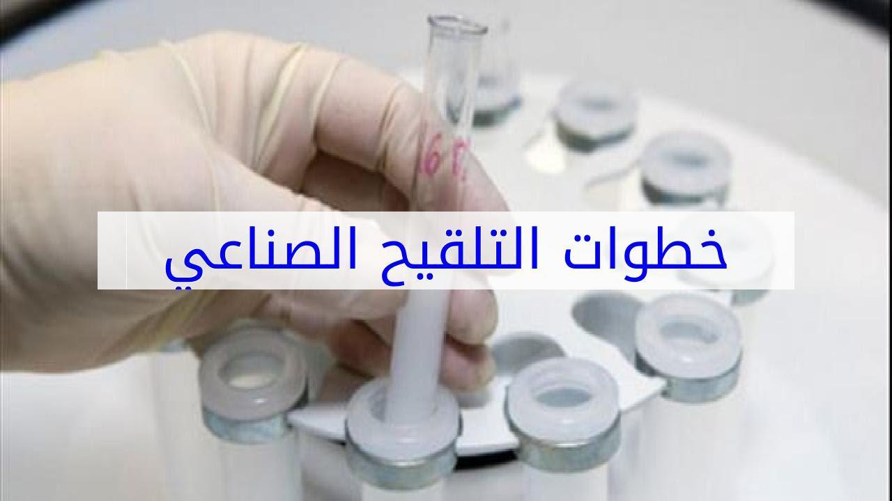 خطوات التلقيح الصناعي - مراحل التلقيح الصناعي 10695 3