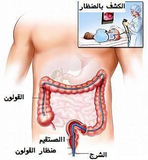 علاج الدبر المفتوح - شق فتحه الشرج اسبابه وعلاجه 13225 1