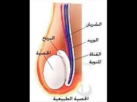 اعراض التهاب البربخ - التهاب البربخ المزمن اسباب وعلاج 12896 1