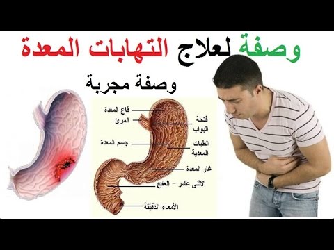 علاج جرثومة المعدة - اسباب الجرثومه واعراضها وعلاجها 12898 2