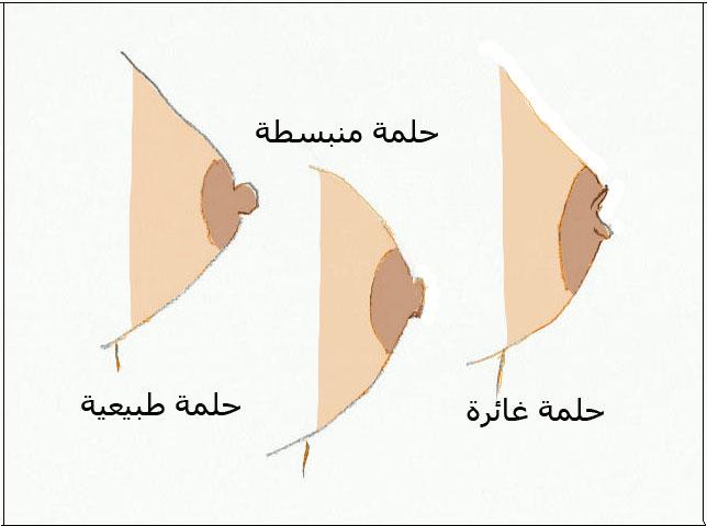 صور انواع الحلمات , ما هو نوع حلمه كل امراه