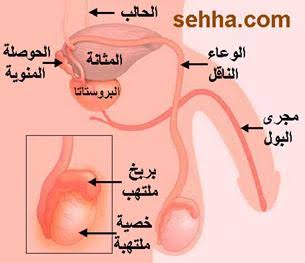 اعراض التهاب البربخ - التهاب البربخ المزمن اسباب وعلاج 12896 2