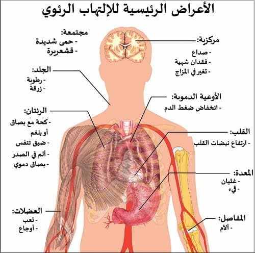 اعراض التهاب الرئة وعلاجها - طرق علاج الالتهابات الرئوى 6720 2