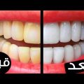 4487 1 طريقة رائعة لتبيض الاسنان في دقيقتين - خلطة تجعل اسنانك مثل المشاهير سمر جدة