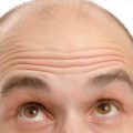 11197 3 اسباب تساقط شعر الحواجب عند الرجال - ما هي اسباب تساقط الشعر عند الرجال ريهام حمادة