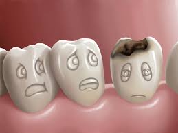 9734 1 علاج ثقب الاسنان - علاج تسوس الاسنان سمر جدة